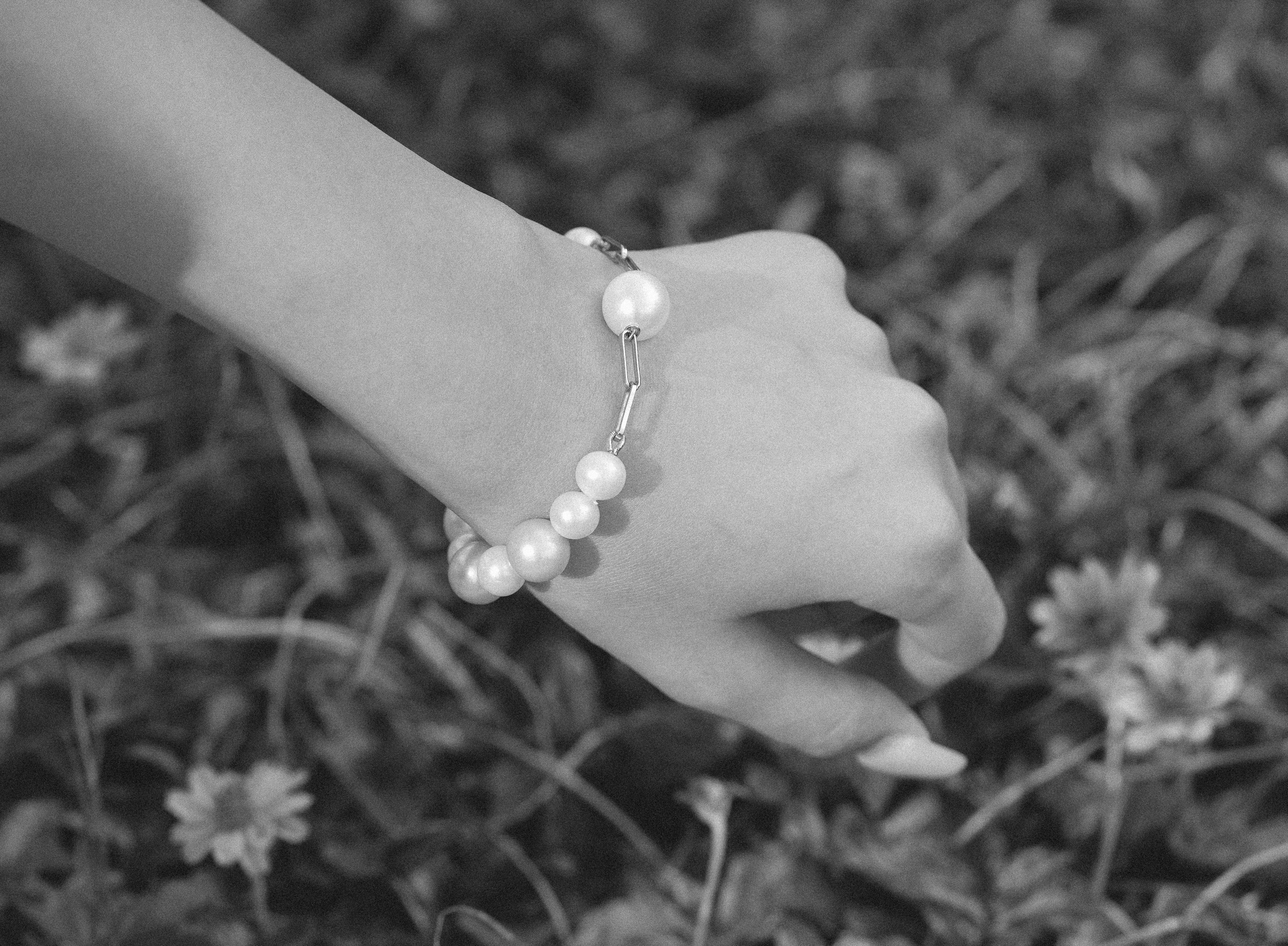 Do real pearls turn yellow?